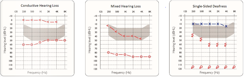 baha charts