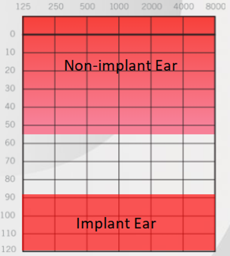 chart4