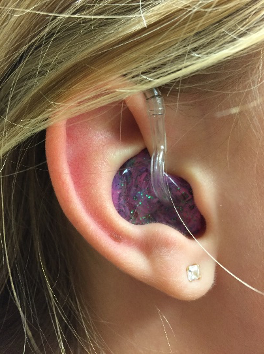 pediatric hearing aid1